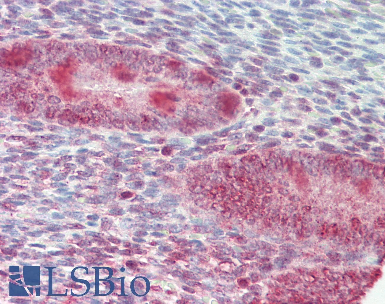 ZFP36L1 Antibody (aa66-115)