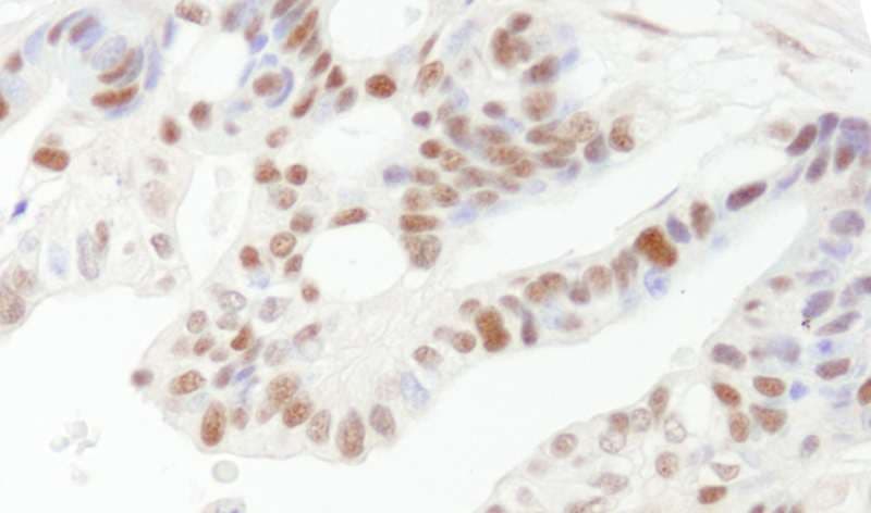 DFFA / ICAD / DFF45 Antibody (aa271-331)