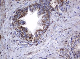 HSPD1 / HSP60 Antibody (clone OTI6F7)