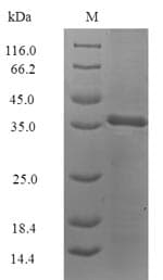 Blattella germanica Allergen Bla g 4 Protein (Recombinant 6His-SUMO, N-terminus)