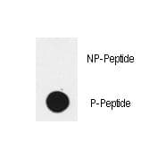Polyclonal Rabbit anti-Human EGFR Antibody (phospho-Tyr1172, WB)