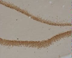 Monoclonal Mouse anti-Human PROX1 Antibody (clone 5G10, IHC)