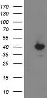 MGLL / Monoacylglycerol Lipase Antibody (clone OTI1A1)