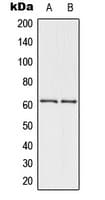 CHEK2 / CHK2 Antibody (phospho-Thr432)