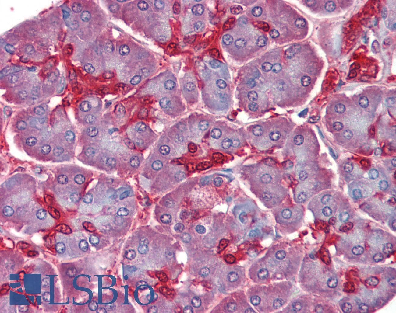 IHC-plus™ SOD1 / Cu-Zn SOD Antibody