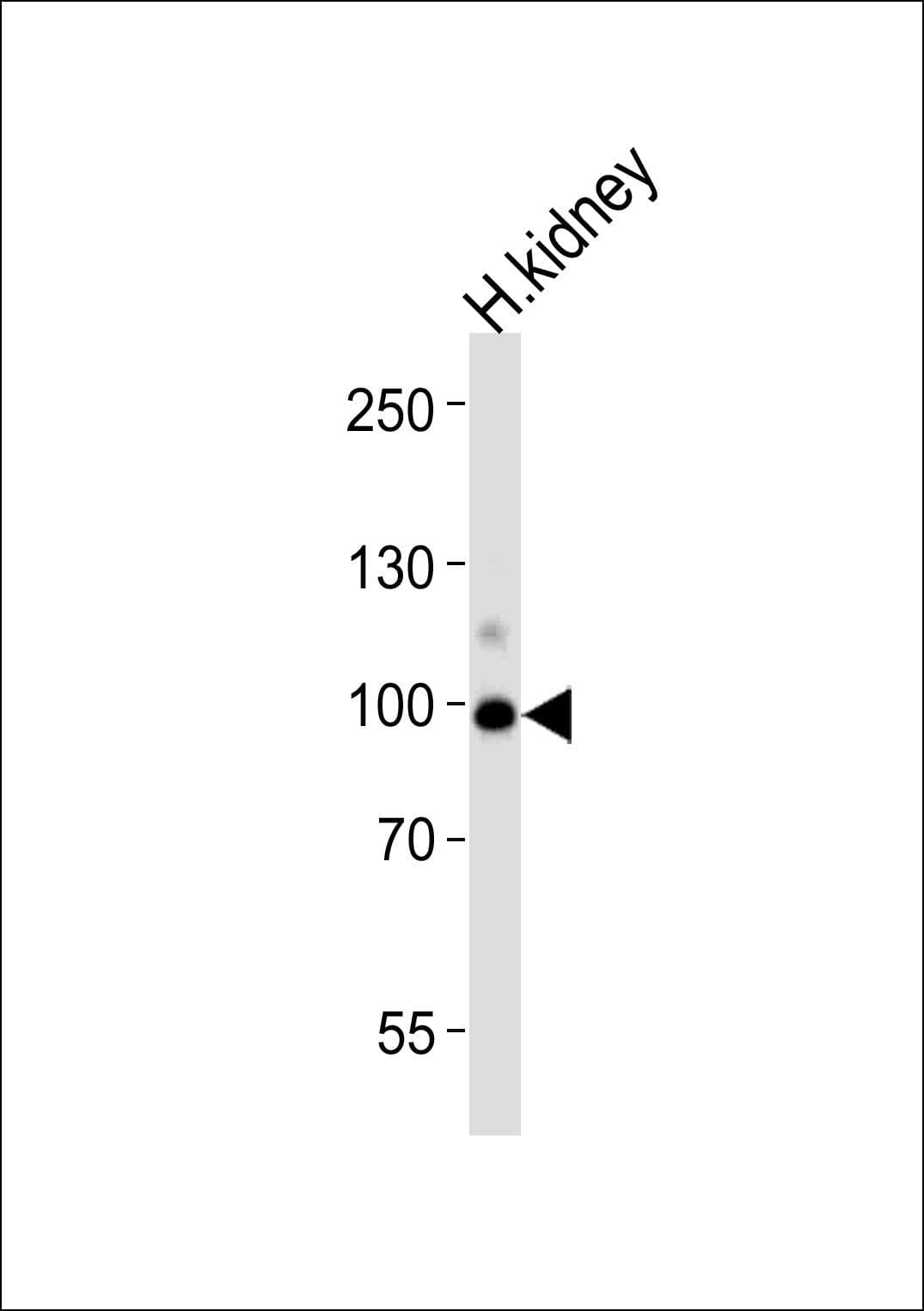 IHC-plus™ ACE2 / ACE-2 Antibody (aa140-172)