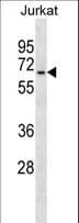 GALNT14 Antibody (aa39-66)