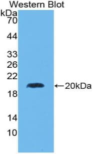 SUPT6H / SPT6 Antibody (aa538-666)