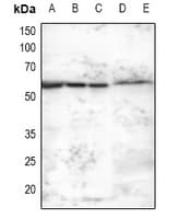 MKNK2 / MNK2 Antibody