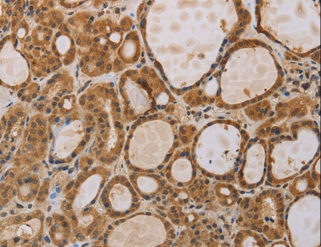 ITIH1 Antibody