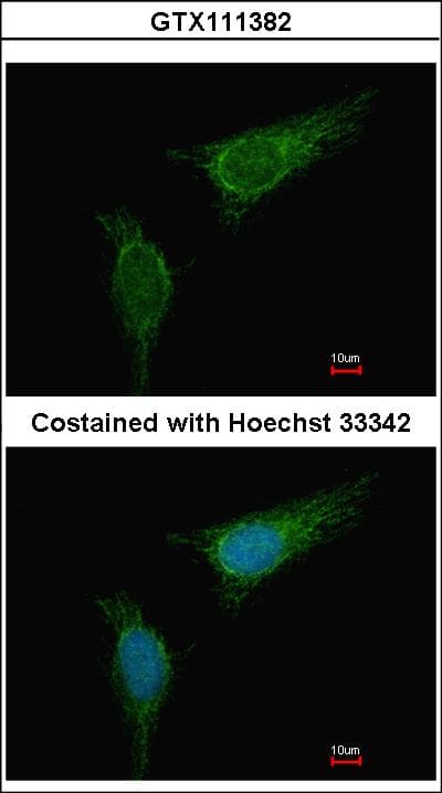 IHC-plus™ Polyclonal Rabbit anti-Human BCKDHA / BCKDE1A Antibody (C-Terminus, IHC, IF, WB)