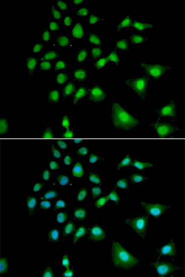 Polyclonal Rabbit anti-Human UBE3C Antibody (IHC, IF, WB)