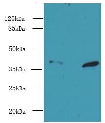 Polyclonal Rabbit anti-Human PSMD7 / MOV34 Antibody (IHC, WB)