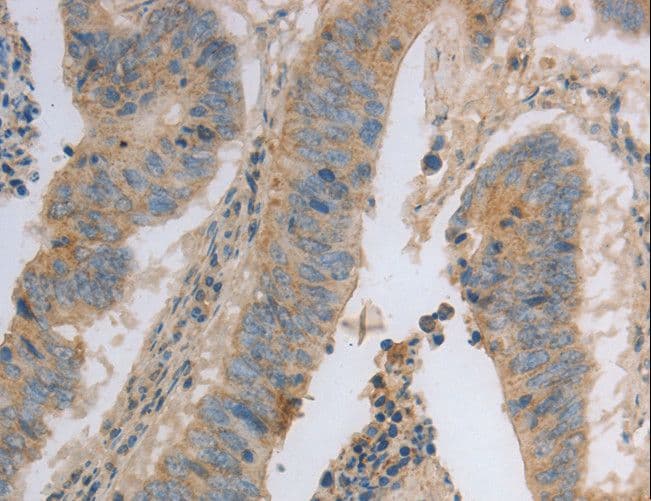 Polyclonal Rabbit anti-Human MAGED1 / NRAGE Antibody (IHC, WB)