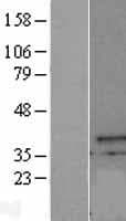 CXorf21 Protein (Over-Expression Lysate Myc-DDK (Flag))