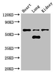 Ceramide Kinase / CERK Antibody