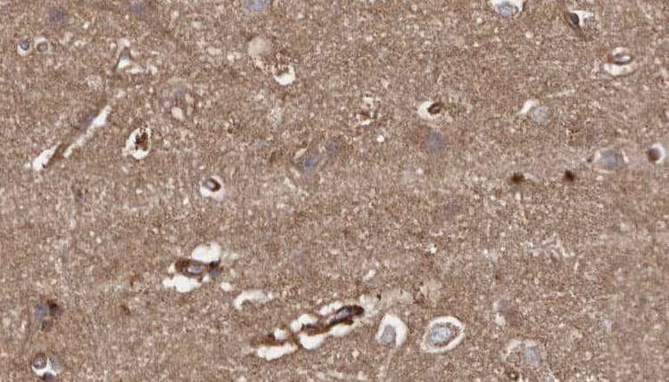 Polyclonal Rabbit anti-Human HACE1 Antibody (IHC, WB)