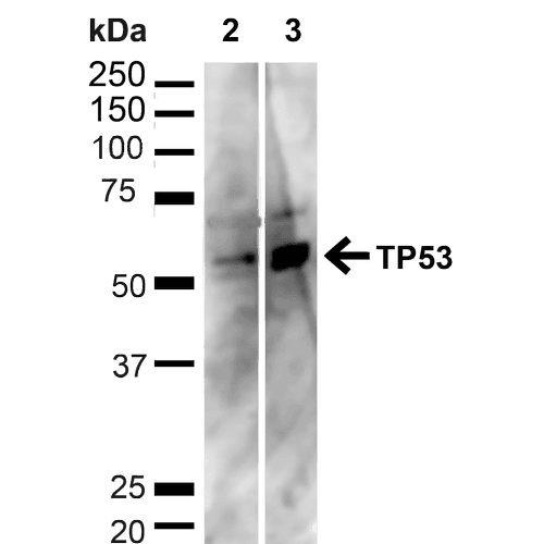 TP53 / p53 Antibody