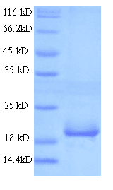 Mouse ANGPTL8 / Betatrophin Protein (Recombinant His)