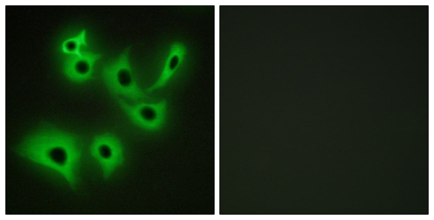 CDH4 / R Cadherin Antibody (aa731-780)