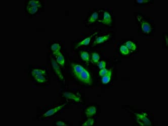 Polyclonal Rabbit anti-Human SIRT5 / Sirtuin 5 Antibody (IHC, IF)
