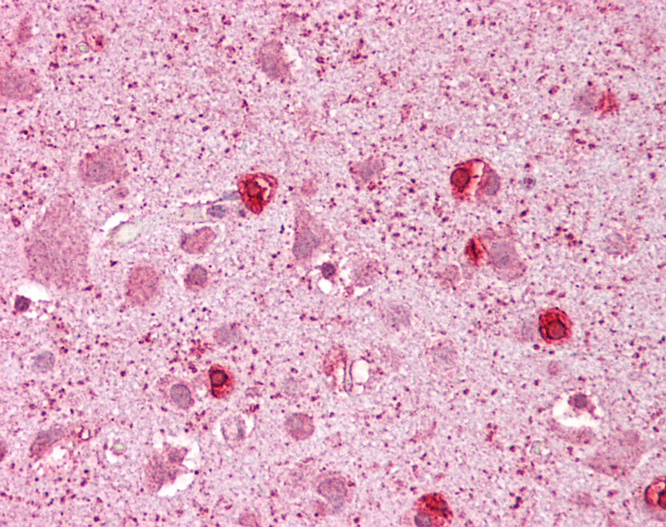 GSX2 / GSH2 Antibody (N-Terminus)