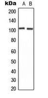 Polyclonal Rabbit anti-Human CNGB1 Antibody (Internal, WB)
