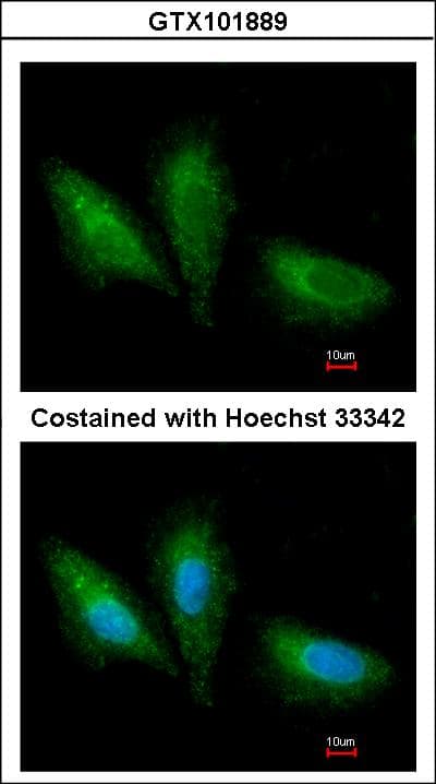 Polyclonal Rabbit anti-Human PRKCSH Antibody (aa1-283, WB)