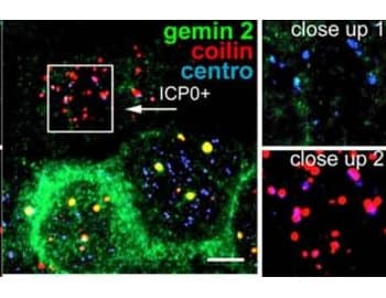 SIP1 Antibody (clone 2E17)