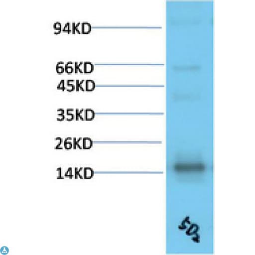 TTR / Transthyretin Antibody