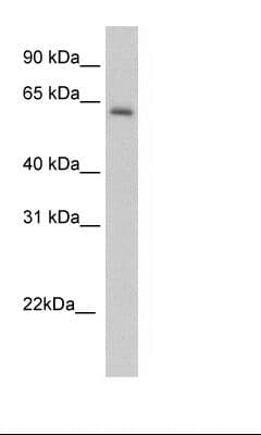 Polyclonal Rabbit anti-Mouse ANXA6/Annexin A6/Annexin VI Antibody (aa501-550, IHC, WB)