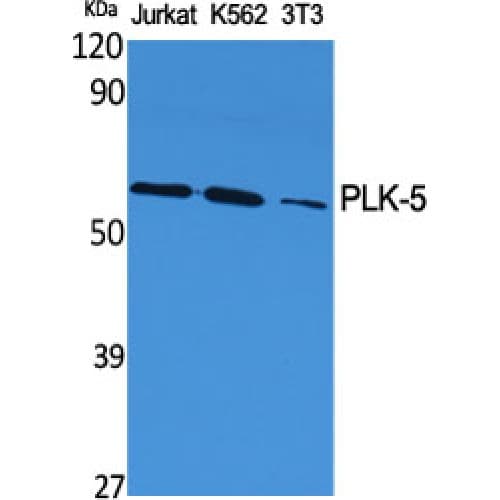 Polyclonal Rabbit anti-Human PLK5 Antibody (320-400 aa, Internal, WB)