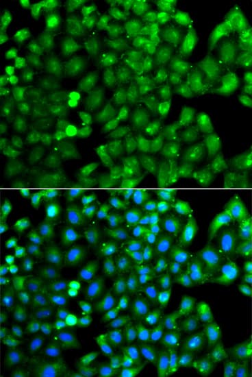 HLA-DRB1 Antibody