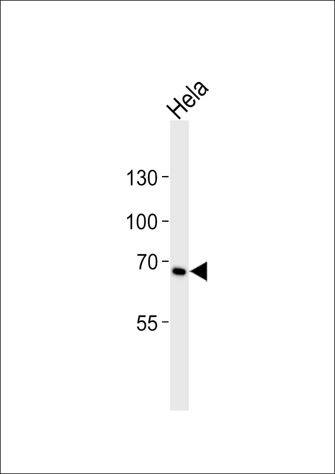 CD30 Antibody (aa30-63)