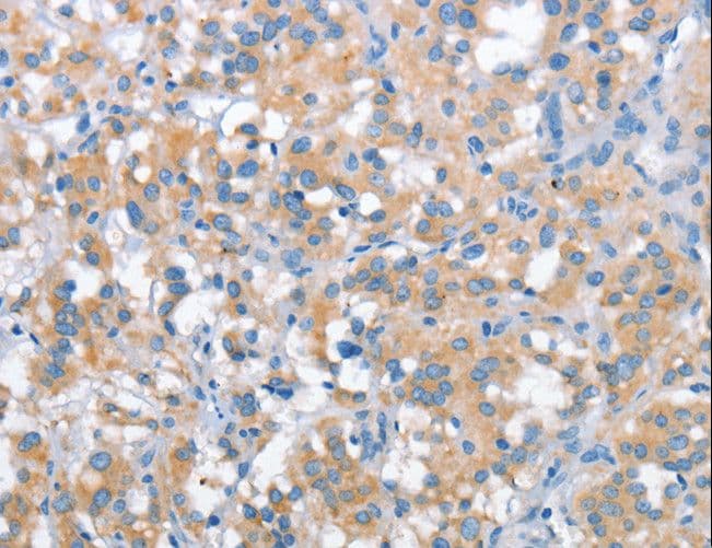 Polyclonal Rabbit anti-Human SNCA / Alpha-Synuclein Antibody (IHC)
