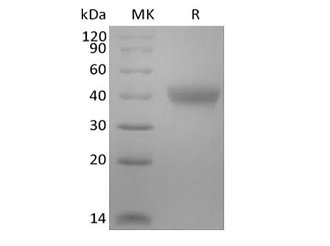 Mouse TNFRSF1B / TNFR2 Protein (Recombinant AVI-6His, C-terminus)