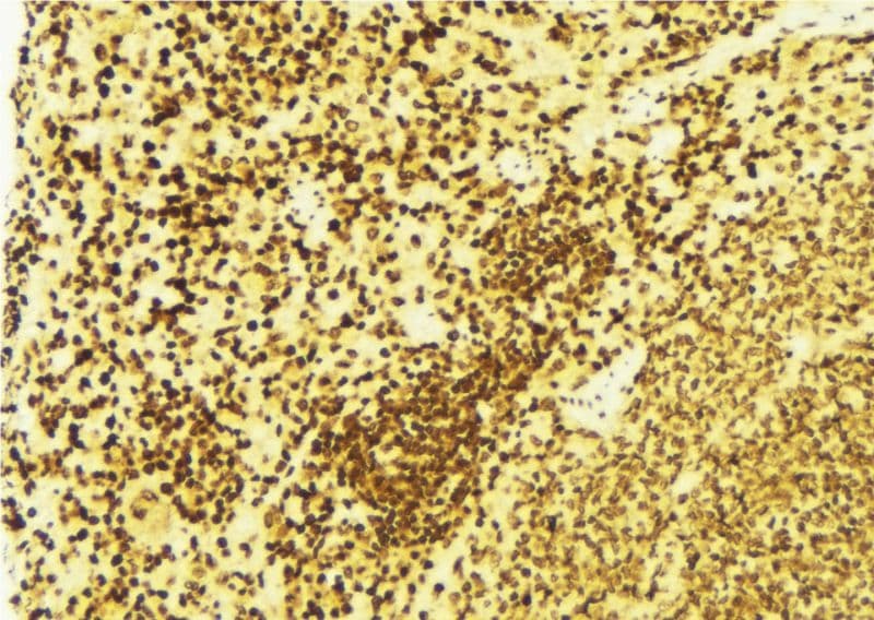 FANCD2 Antibody