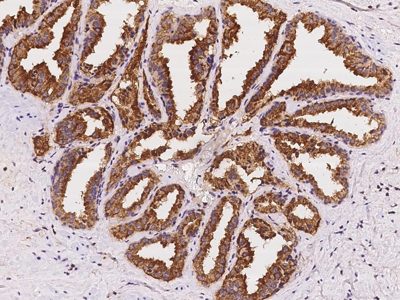 RAB3B Antibody