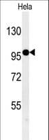 Polyclonal Rabbit anti-Human ARHGAP39 Antibody (aa852-880, WB)