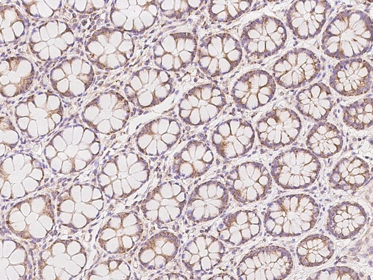 Polyclonal Rabbit anti-Human FPGS Antibody (IHC)