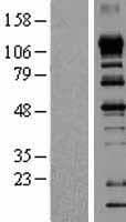 EIF4ENIF1 / 4E-T Protein (Over-Expression Lysate Myc-DDK (Flag))