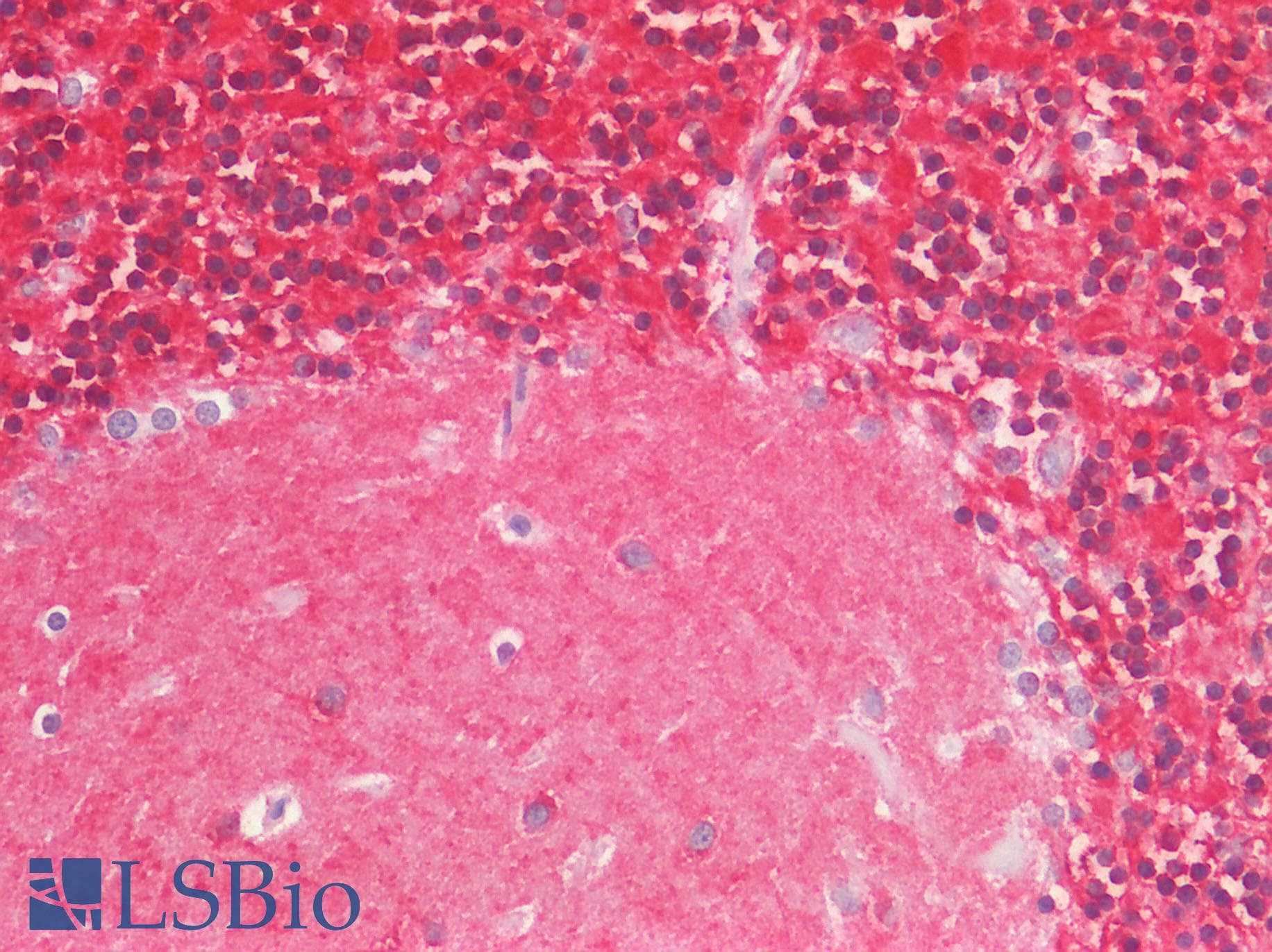 PathPlus™ Monoclonal Mouse anti-Human IL17A Antibody (clone 4K5F6, aa1-75, IHC, WB)