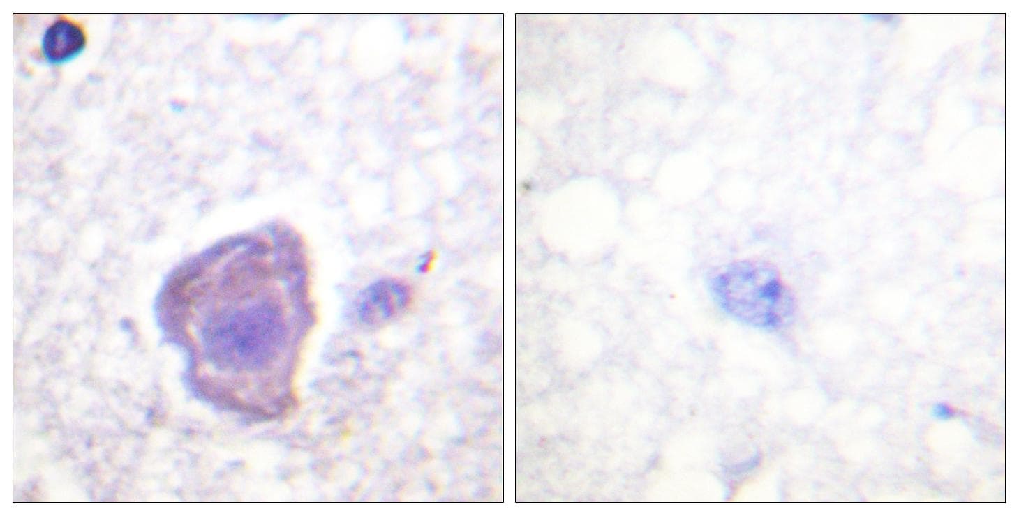 FAK / Focal Adhesion Kinase Antibody