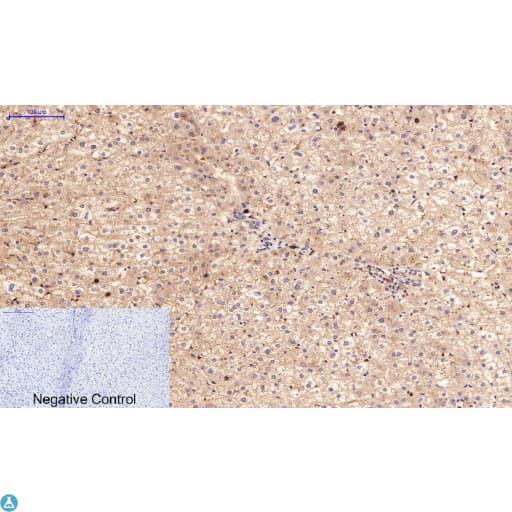 TUBE1 / Tubulin Epsilon Antibody