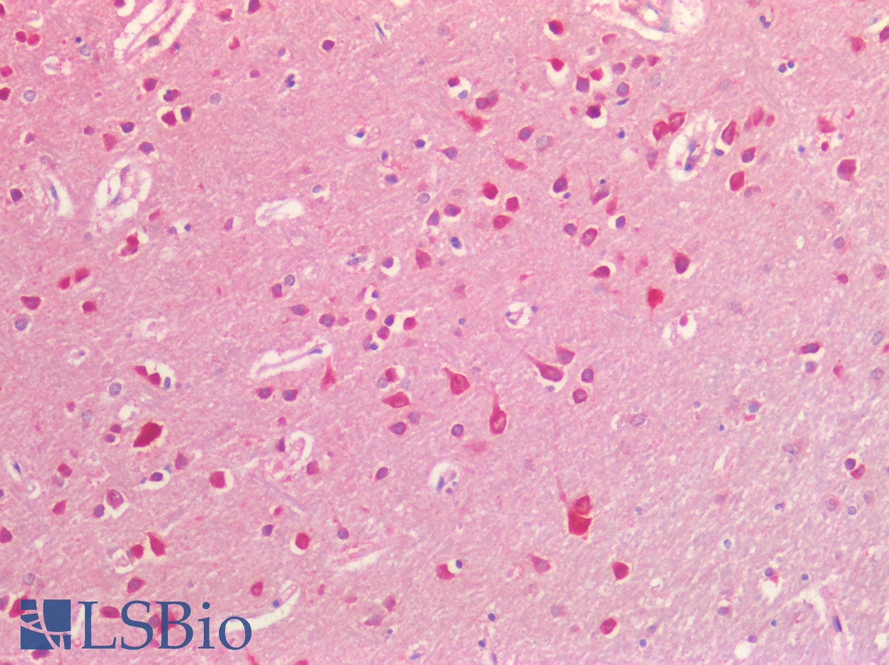 PathPlus™ Polyclonal Goat anti-Human EFNB2 / Ephrin B2 Antibody (aa62-74, IHC, WB)