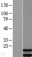 ARPP19 Protein (Over-Expression Lysate Myc-DDK (Flag))