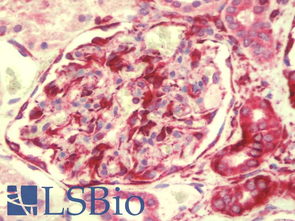 IHC-plus™ ZMYM1 Antibody