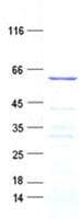 Human ACOXL Protein (Recombinant His, N-Terminal)