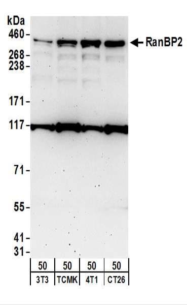 IHC-plus™ RANBP2 / TRP1 Antibody (aa1050-1100)