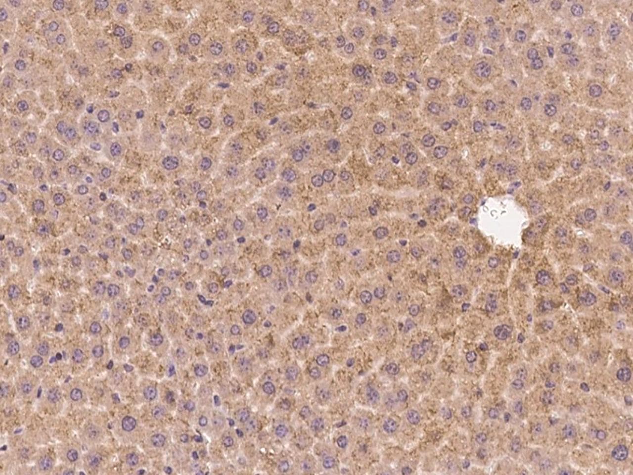 INHBB / Inhibin Beta B Antibody (Preservative Free)